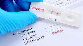  400 Warga Kecamatan Bukit Raya Gelar Rapid Test, 3 Dinyatakan Reaktif Covid-19